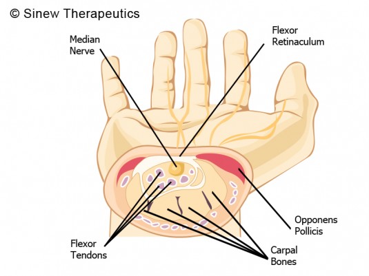 wrist20tendons